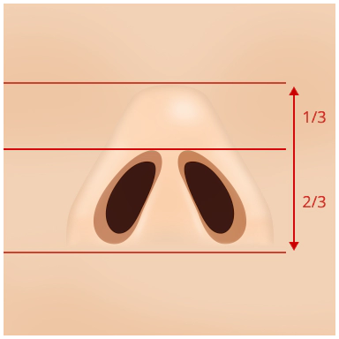 Rasio Ideal 2: Panjang lubang hidung menutupi 2/3 dari seluruh hidung.