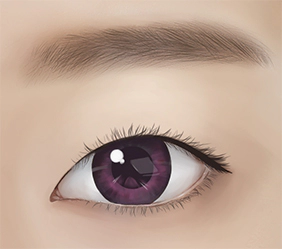 Sebelum Koreksi Ptosis Mata.