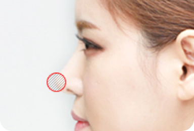 Ragam dan Ciri Khusus Tulang Rawan: Tulang Rawan Septum.