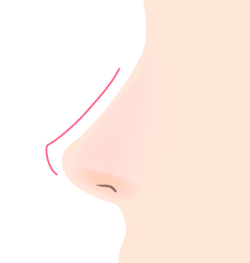Ragam Jenis Garis Hidung: Ragam Jenis Garis Hidung.