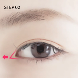 Metode Bedah Kantoplasti Mata Besar Tahap 2.