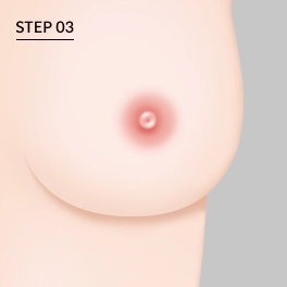 Langkah 3:Jahit kembali sambil menjaga bentuk areola yang bulat.