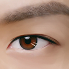 4 : Metode Bedah Sub-brow Lifting Kelopak Mata Pria MINE.