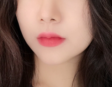 Gambar Sesudah Botox.