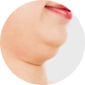 Penguraian lemak double chin yang tebal.