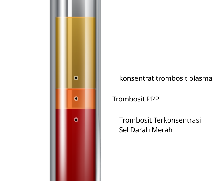 Cangkok Lemak Payudara PRP