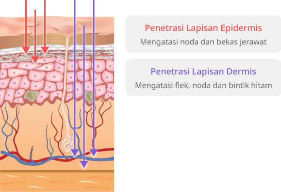 Pemutih kulit indonesia lapisan superfisial.