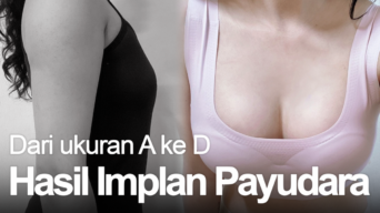 Dulu kayak papan, sekarang udah jadi montong!?